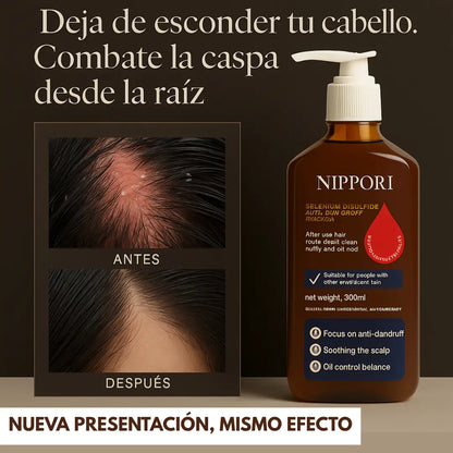 Shampoo Anticaspa Nippori® + ENVÍO GRATIS